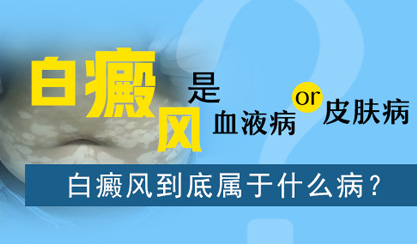 南京华厦白癜风医? /></li></a>
  <a href=